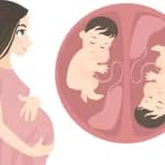 IVF multiple pregnancies : Pregnant woman expecting twins illustration babies in womb