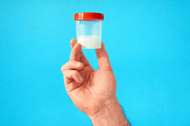 Hand holding medical specimen container with red cap on blue background representing free sperm donation sample collection