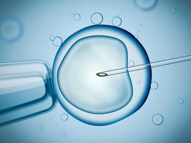 IVF procedure illustrating IVF success rates