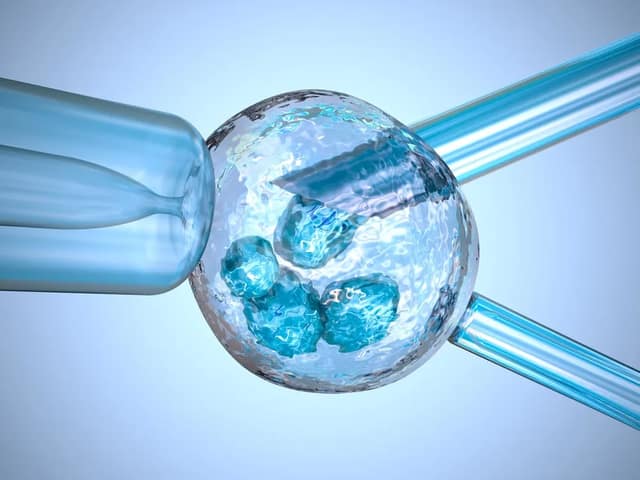 Donor sperm insemination illustration showing fertilization of egg with laboratory pipette