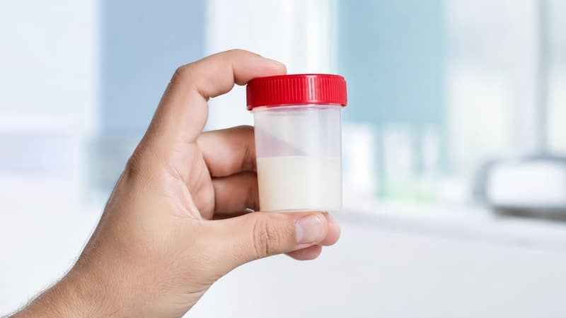 Donate sperm by providing a semen sample in a collection container