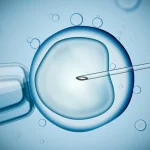 IVF procedure illustrating IVF success rates