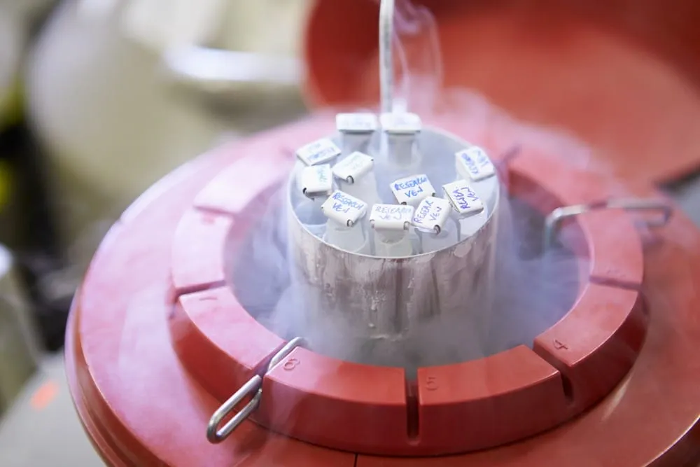 Sperm bank process cryogenic tank storing frozen sperm samples in a fertility clinic