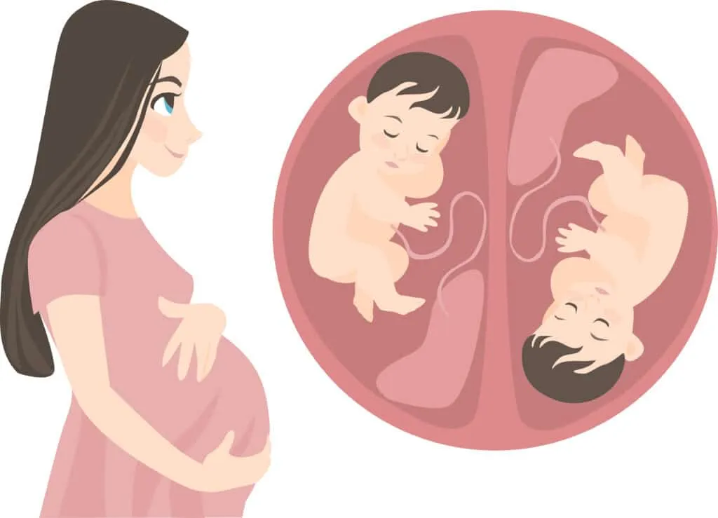 IVF multiple pregnancies : Pregnant woman expecting twins illustration babies in womb