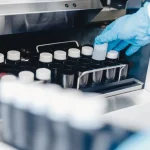 Prices Sperm bank in London - Laboratory technician handling frozen sperm samples at London fertility clinic